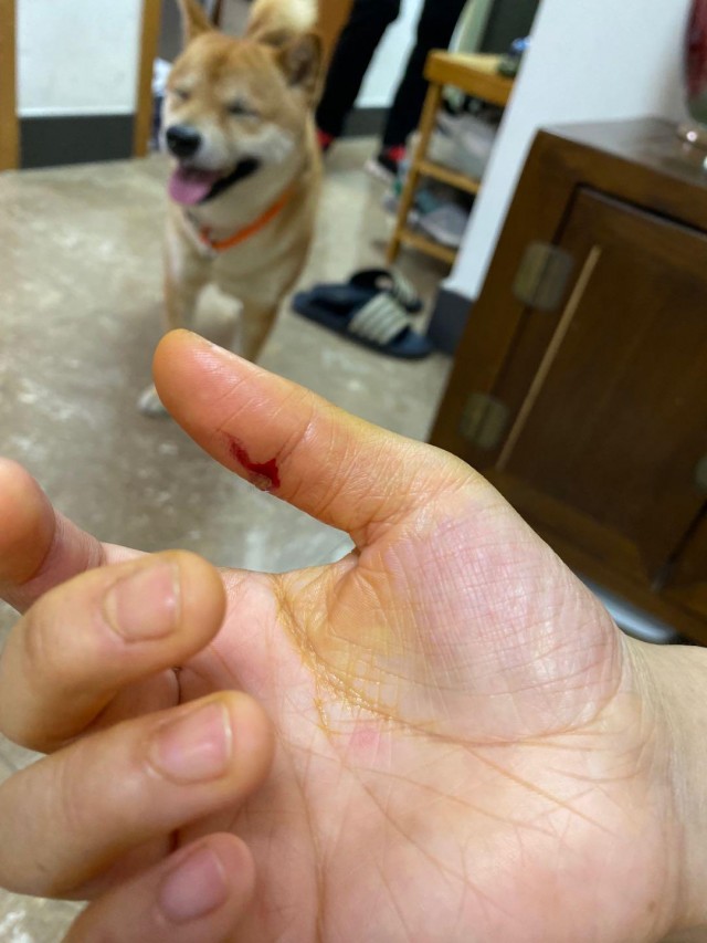 柴犬过于敏感主人帮柴犬狗狗擦身怎料它扭头就把主人咬到流血